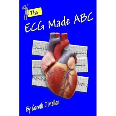 The ECG Made ABC