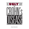 The Ugly Story of Crohn's Disease
