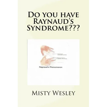 Do you have Raynaud's Syndrome