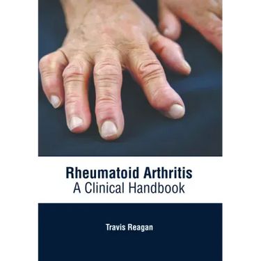 Rheumatoid Arthritis: A Clinical Handbook