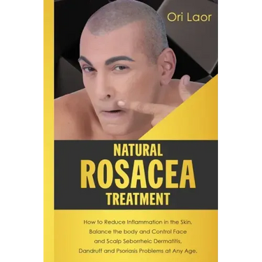 Natural Rosacea Treatment: How to Reduce Inflammation in the Skin, Balance the body and Control Face and Scalp Seborrheic Dermatitis, Dandruff an