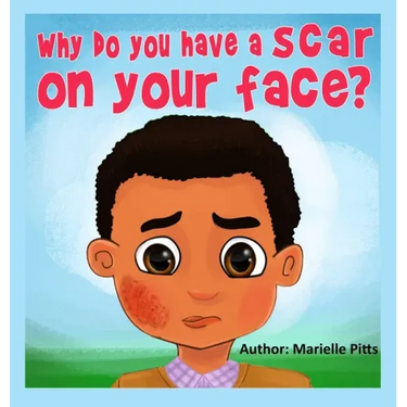 Why do you have a scar on your face?