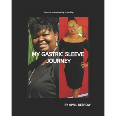 My Gastric Sleeve Journey: The ends and Outs About Gastric Sleeve