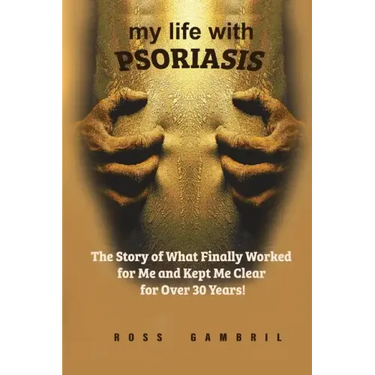 my life with PSORIASIS: The story of what finally worked for me and kept me clear for over 30 years!