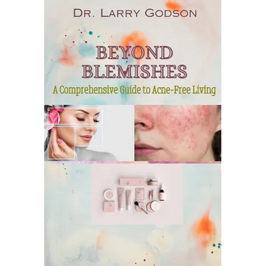 Beyond Blemishes: A Comprehensive Guide to Acne-Free Living/ Skincare Bible for Radiant Skin