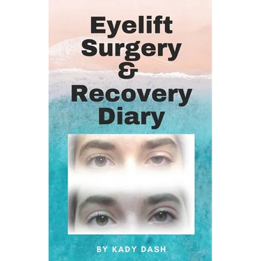 Eyelift Surgery and Recovery Diary: Ptosis, eyelifts, punctal plugs, and dry eyes