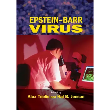 Epstein-Barr Virus