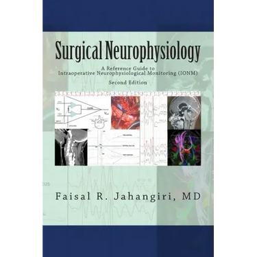 Surgical Neurophysiology - 2nd Edition: A Reference Guide to Intraoperative Neurophysiological Monitoring
