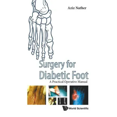 Surgery for Diabetic Foot: A Practical Operative Manual