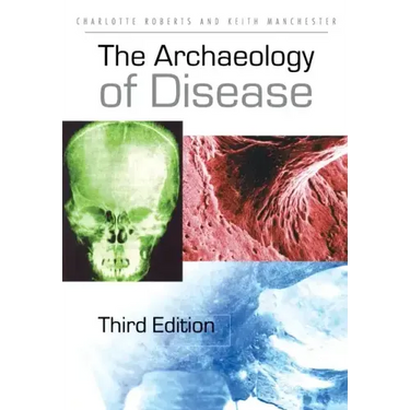 The Archaeology of Disease
