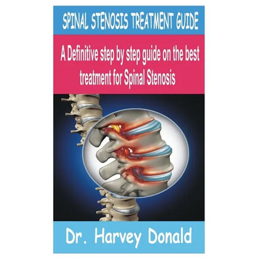Spinal Stenosis Treatment Guide: A Definitive step by step guide on the best treatment for Spinal Stenosis