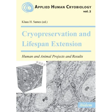 Cryopreservation and Lifespan Extension. Human and Animal Projects and Results