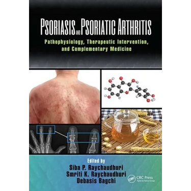 Psoriasis and Psoriatic Arthritis: Pathophysiology, Therapeutic Intervention, and Complementary Medicine