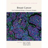 Breast Cancer: From Fundamental Biology to Therapeutic Strategies