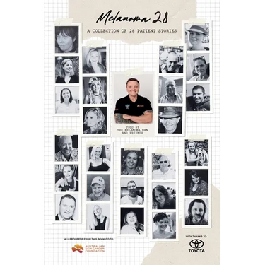 Melanoma 28