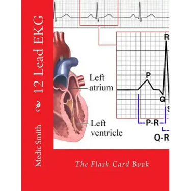 12 Lead EKG: The Flash Card Book