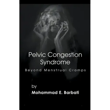 Pelvic Congestion Syndrome - Beyond Menstrual Cramps