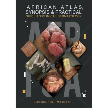African Atlas, Synopsis & Practical Guide to Clinical Dermatology