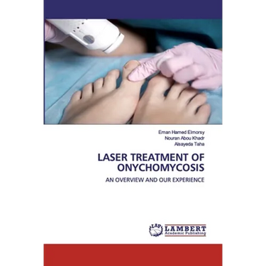 Laser Treatment of Onychomycosis