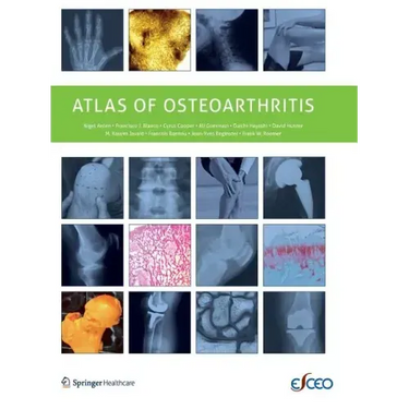 Atlas of Osteoarthritis