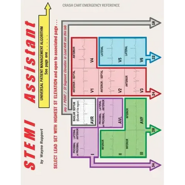 STEMI Assistant