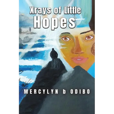 Xrays Of Little Hopes