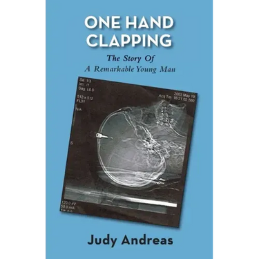 One Hand Clapping