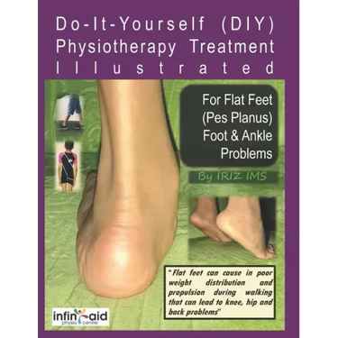 Physiotherapy Treatment Illustrated For Flat Feet (Pes Planus) Foot & Ankle Problems