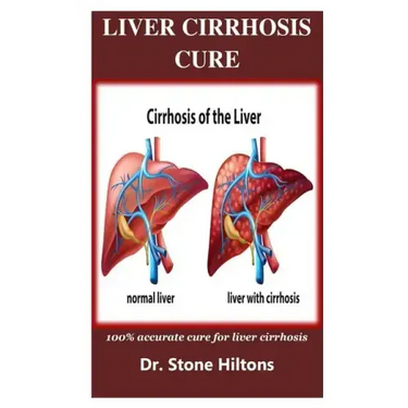 Liver Cirrhosis Cure: 100% accurate cure for liver cirrhosis