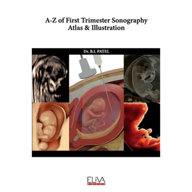 A-Z of First Trimester Sonography Atlas & Illustration