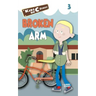 Broken Arm