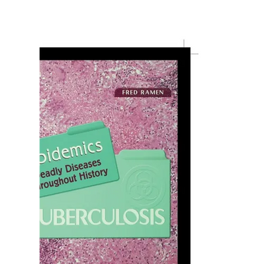 Tuberculosis