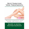 Best Varicose Vein Treatments: Natural Remedies That Work For Varicose