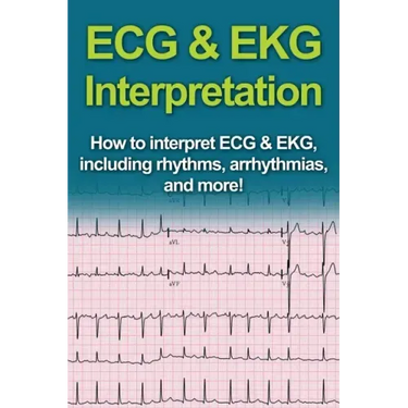 ECG & EKG Interpretation: How to interpret ECG & EKG, including rhythms, arrhythmias, and more!
