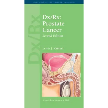 DX/Rx: Prostate Cancer: Prostate Cancer