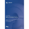 MRI in Prostate Cancer
