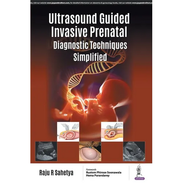 Ultrasound Guided Invasive Prenatal Diagnostic Techniques Simplified
