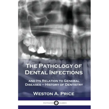 The Pathology of Dental Infections: and Its Relation to General Diseases - History of Dentistry