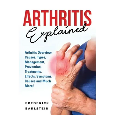 Arthritis Explained: Arthritis Overview, Causes, Types, Management, Prevention, Treatments, Effects, Symptoms, Causes and Much More!