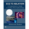 ECG to Ablation: A Comprehensive Guide to Cardiac Electrophysiology