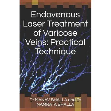 Endovenous Laser Treatment of Varicose Veins: Practical Technique