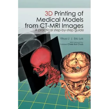 3D Printing of Medical Models from CT-MRI Images: A Practical step-by-step guide