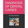Diagnosis of Dental Caries