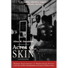 Acres of Skin: Human Experiments at Holmesburg Prison