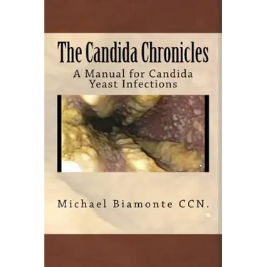 The Candida Chronicles: A Mannual for Candida/Yeast Infections