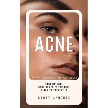 Acne: Proven Natural Remedies for Acne-free Skin (Easy Natural Home Remedies for Acne & How to Prevent It)