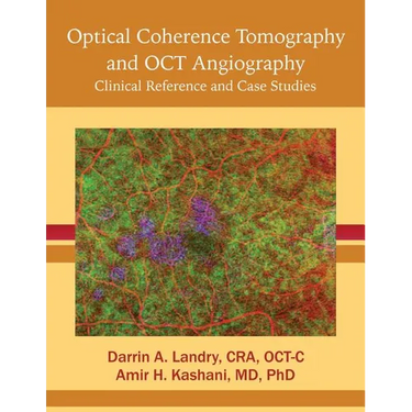 Optical Coherence Tomography and OCT Angiography: Clinical Reference and Case Studies
