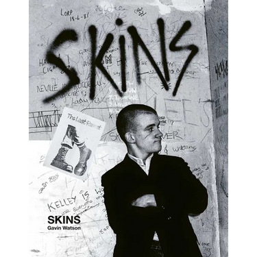 Skins: Gavin Watson