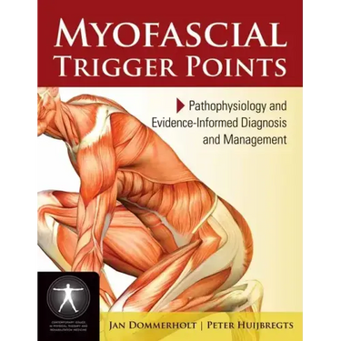 Myofascial Trigger Points: Pathophysiology and Evidence-Informed Diagnosis and Management: Pathophysiology and Evidence-Informed Diagnosis and Managem
