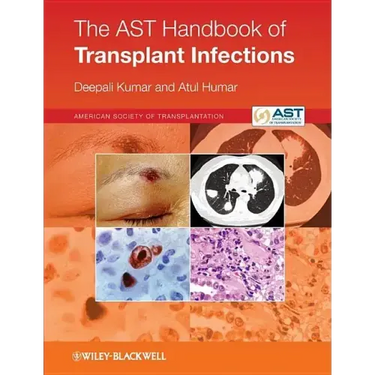 The Ast Handbook of Transplant Infections